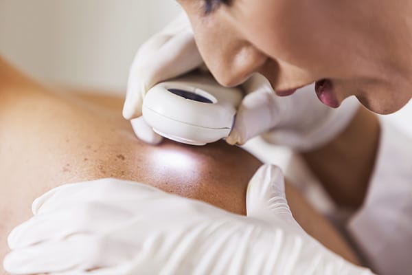 What to Expect From a Skin Check