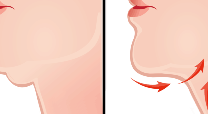 Double Chin Discount for a Newly Assured Profile