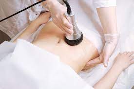 What’s ultrasonic cavitation therapy?