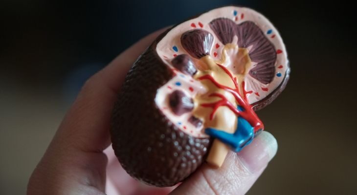 Signs and Remedy for Kidney Stones in Ladies